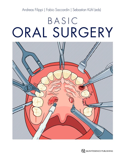 Basic Oral Surgery - 