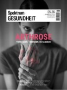 Cover-Bild zum Titel 'Spektrum Gesundheit 5/2026 - Arthrose' von ''