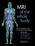 Cover-Bild zum Titel 'MRI of the Whole Body' von 'Nikhil Bhuskute, Kshitij Mankad, Amit Lakkaraju, Edward Hoey'