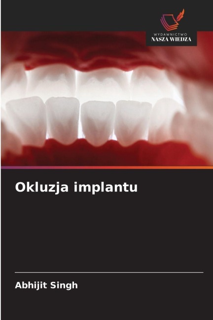 Okluzja implantu - Abhijit Singh