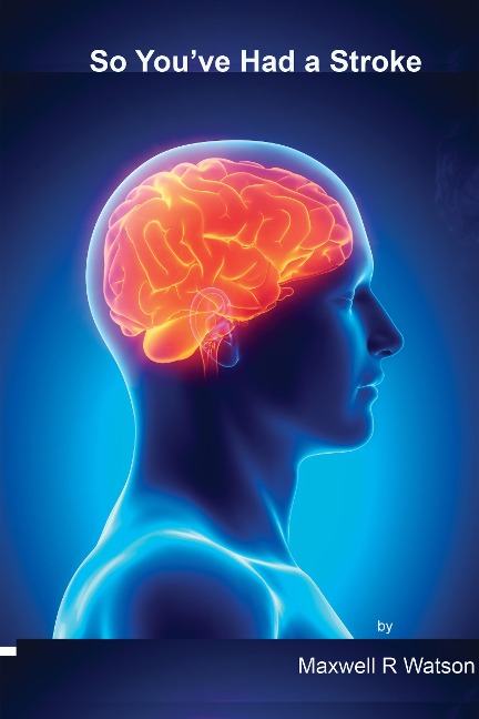 So You've Had A Stroke - Maxwell R Watson