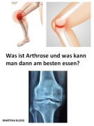 Cover-Bild zum Titel 'Was ist Arthrose und was kann man dann am besten essen?' von 'Martina Kloss'