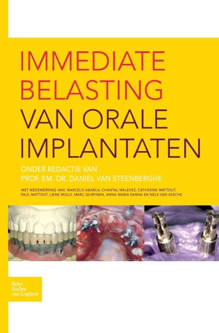 Immediate Belasting Van Orale Implantaten - D. Steenberghe