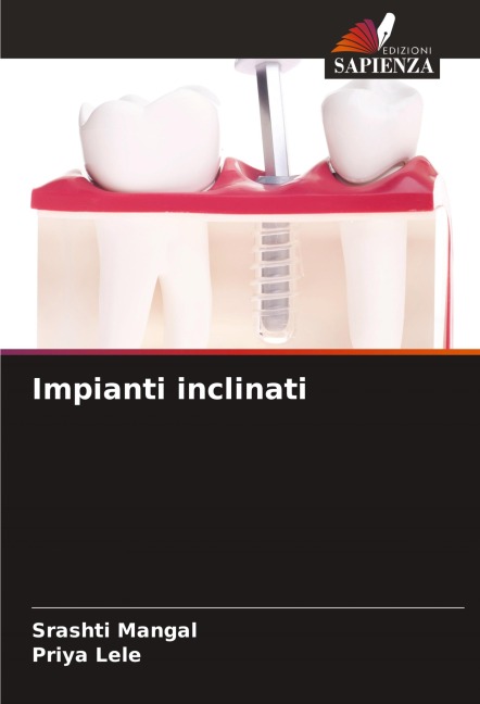 Impianti inclinati - Srashti Mangal, Priya Lele