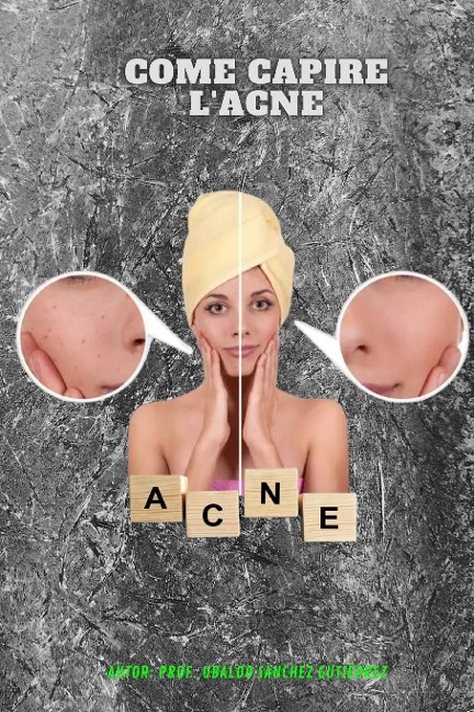 Come capire l'acne - Ubaldo Sánchez Gutiérrez