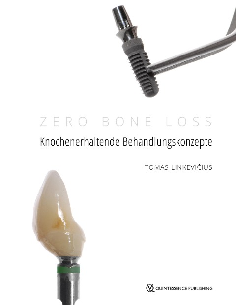 Zero Bone Loss: Knochenerhaltende Behandlungskonzepte - Tomas Linkevicius