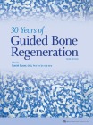  30 Years of Guided Bone Regeneration