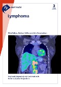Cover-Bild zum Titel 'Fast Facts: Lymphoma' von 'C. Hatton, G. Collins, J. Sweetenham'