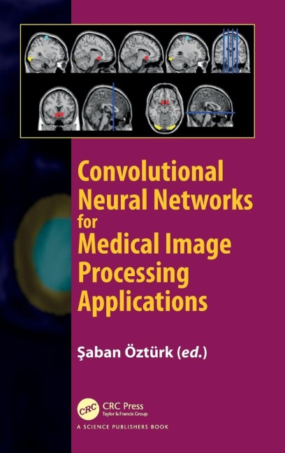 Convolutional Neural Networks for Medical Image Processing Applications - 