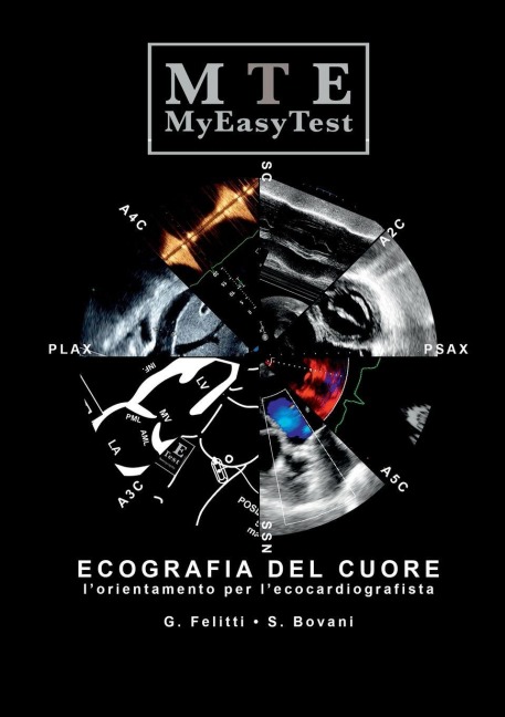 Ecografia del Cuore - MyEasyTest - Giuseppe Felitti, Stefano Bovani