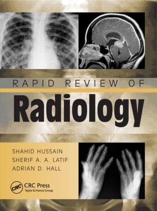 Rapid Review of Radiology - Adrian David Hall, Shahid Hussain, Sherif Aaron Abdel Latif