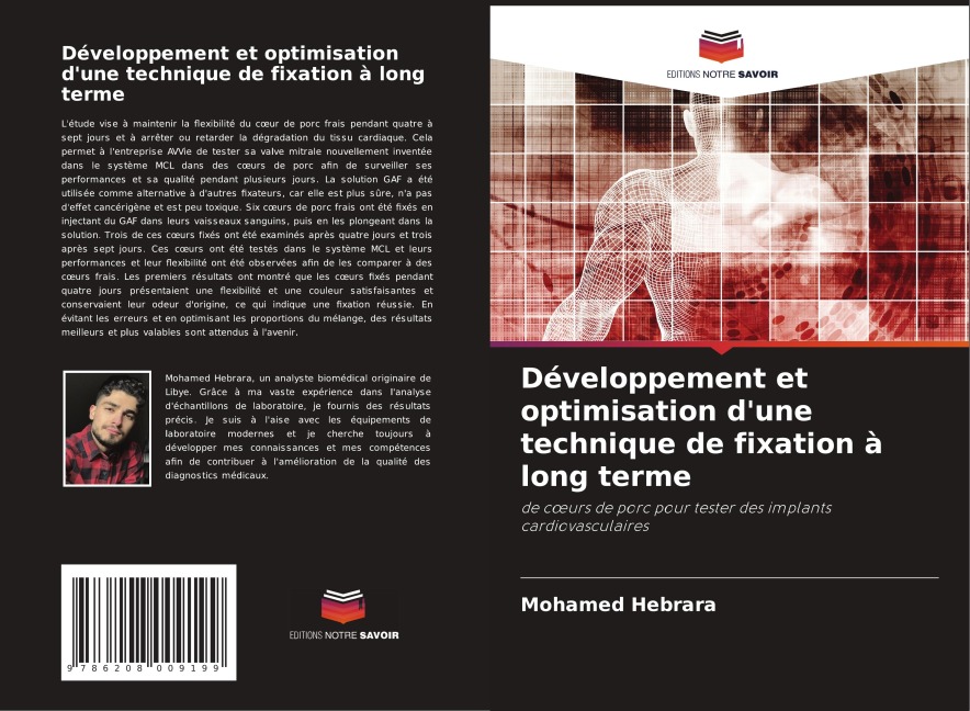 Développement et optimisation d'une technique de fixation à long terme - Mohamed Hebrara