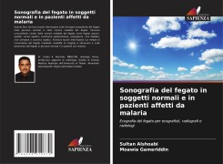 Sonografia del fegato in soggetti normali e in pazienti affetti da malaria - Sultan Alshoabi, Moawia Gameriddin