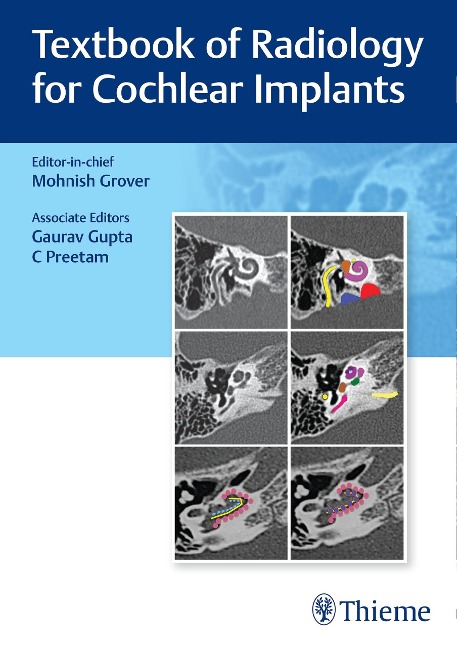 Textbook of Radiology for Cochlear Implants - 