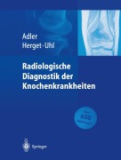 Cover-Bild zum Titel 'Radiologische Diagnostik der Knochenkrankheiten' von 'Claus-Peter Adler, Markus Uhl, Georg Herget'