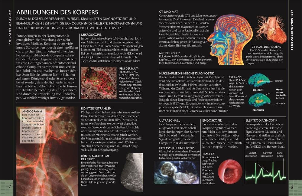 InsideView 3