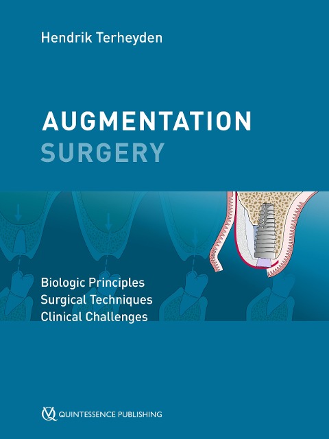 Augmentation Surgery - Hendrik Terheyden