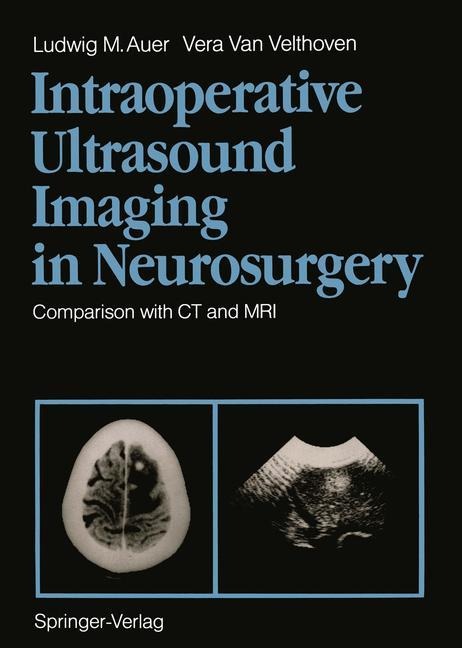 Intraoperative Ultrasound Imaging in Neurosurgery - Vera Van Velthoven, Ludwig M. Auer