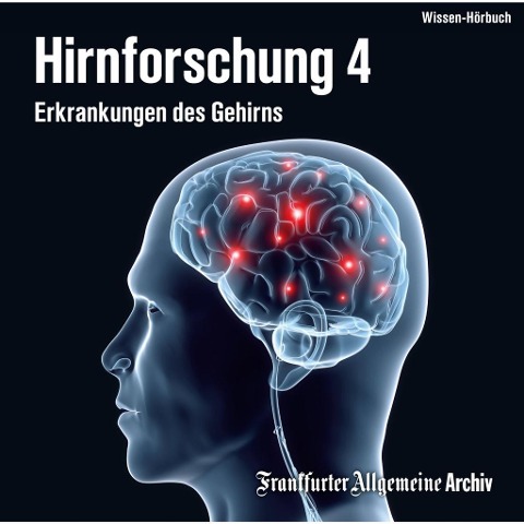 Hirnforschung 4 - 