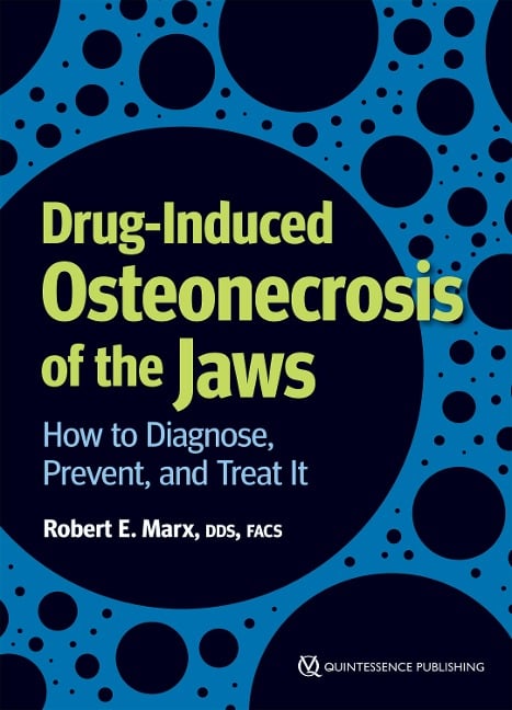 Drug-Induced Osteonecrosis of the Jaws - Robert E. Marx