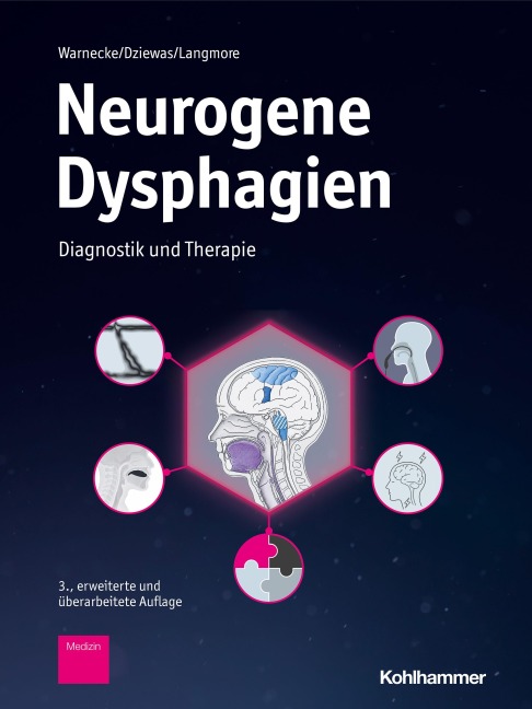 Neurogene Dysphagien - Tobias Warnecke, Susan Langmore, Rainer Dziewas
