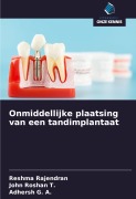Cover-Bild zum Titel 'Onmiddellijke plaatsing van een tandimplantaat' von 'Reshma Rajendran, John Roshan T., Adhersh G. A.'