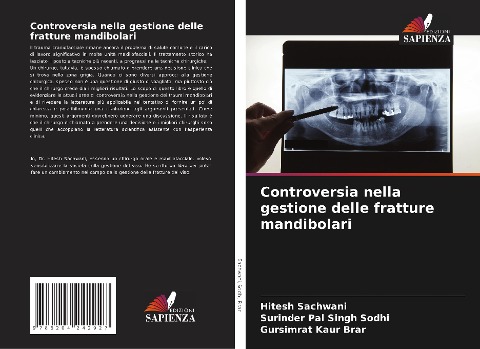 Controversia nella gestione delle fratture mandibolari - Hitesh Sachwani, Surinder Pal Singh Sodhi, Gursimrat Kaur Brar