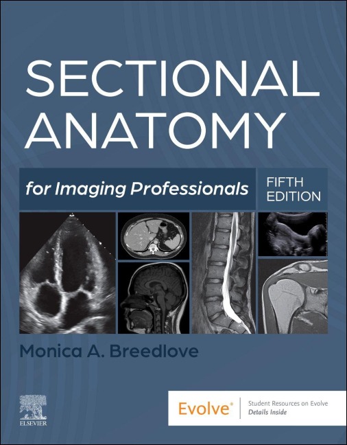Sectional Anatomy for Imaging Professionals - Monica Breedlove