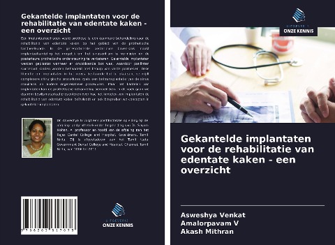Gekantelde implantaten voor de rehabilitatie van edentate kaken - een overzicht - Asweshya Venkat, Amalorpavam V, Akash Mithran