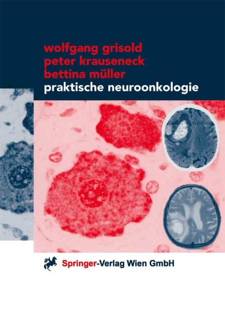 Praktische Neuroonkologie - Wolfgang Grisold, Bettina Müller, Peter Krauseneck