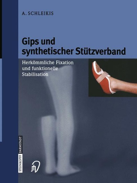 Gips und synthetischer Stützverband - A. Schleikis