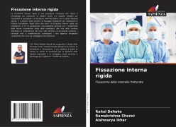 Cover-Bild zum Titel 'Fissazione interna rigida' von 'Rahul Dahake, Ramakrishna Shenoi, Aishwarya Ikhar'