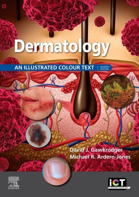 Dermatology E-Book - David Gawkrodger, Michael R. Ardern-Jones
