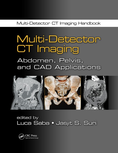 Multi-Detector CT Imaging - 