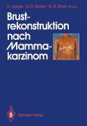 Cover-Bild zum Titel 'Brustrekonstruktion nach Mammakarzinom' von ''