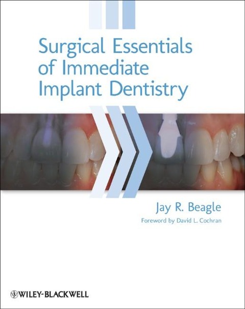 Surgical Essentials of Immediate Implant Dentistry - Jay R. Beagle