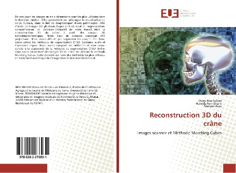Reconstruction 3D du crâne - Dorra Ben Sellem, Hamida Romdhane, Meriem Jlassi