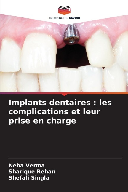 Implants dentaires : les complications et leur prise en charge - Neha Verma, Sharique Rehan, Shefali Singla