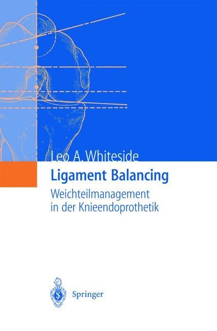 Ligament Balancing - Leo A. Whiteside