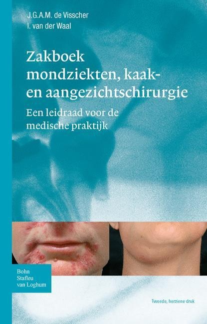 Zakboek Mondziekten, Kaak- En Aangezichtschirurgie - J G a M de Visscher, I van der Waal