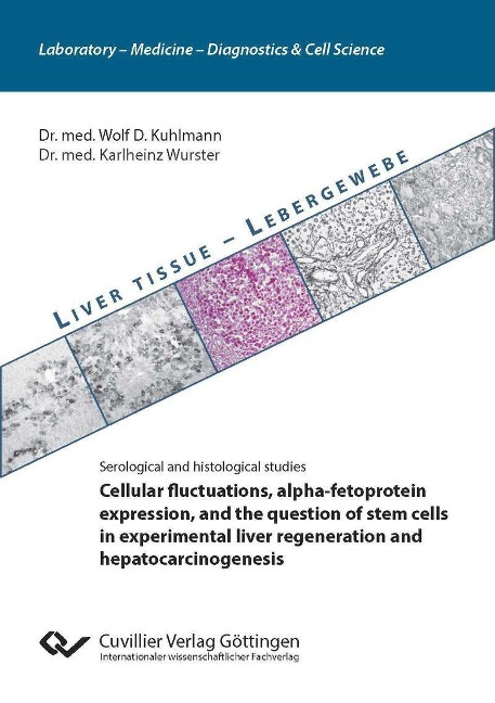 Cellular fluctuations, alpha-fetoprotein expression, and the question of stem cells in experimental liver regeneration and hepatocarcinogenesis - 