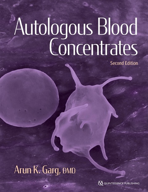 Autologous Blood Concentrates - Arun K. Garg