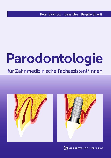 Parodontologie für Zahnmedizinische Fachassistent*innen - Peter Eickholz, Ivana Elez, Brigitte Strauß