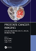 Cover-Bild zum Titel 'Prostate Cancer Imaging' von ''