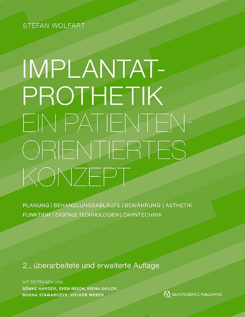 Implantatprothetik - Stefan Wolfart, Bogna Stawarczyk