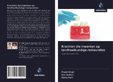 Krachten die inwerken op tandheelkundige restauraties - Preeti Singh, Atul Jadhav, Neetu Rani
