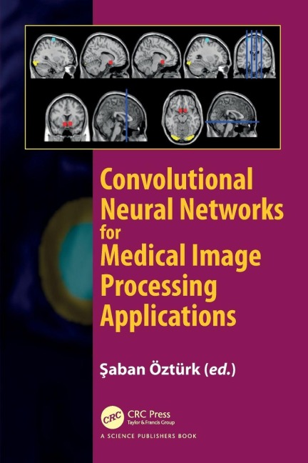 Convolutional Neural Networks for Medical Image Processing Applications - 