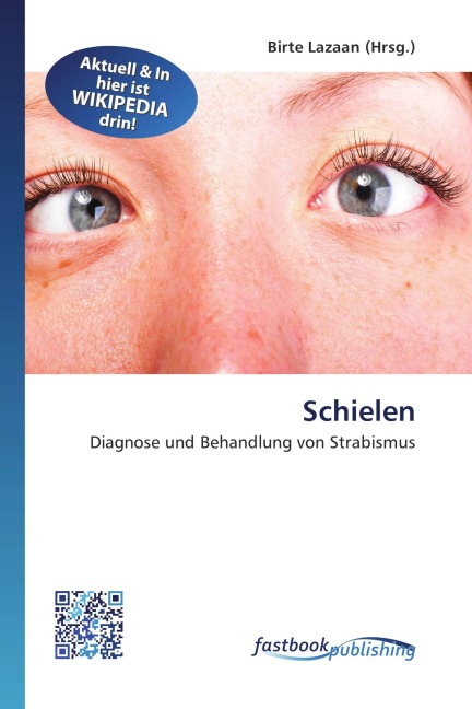 Schielen - 