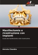 Cover-Bild zum Titel 'Maxillectomia e ricostruzione con impianti' von 'Amruta Chandra'