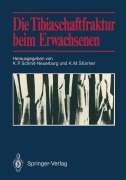 Cover-Bild zum Titel 'Die Tibiaschaftfraktur beim Erwachsenen' von ''